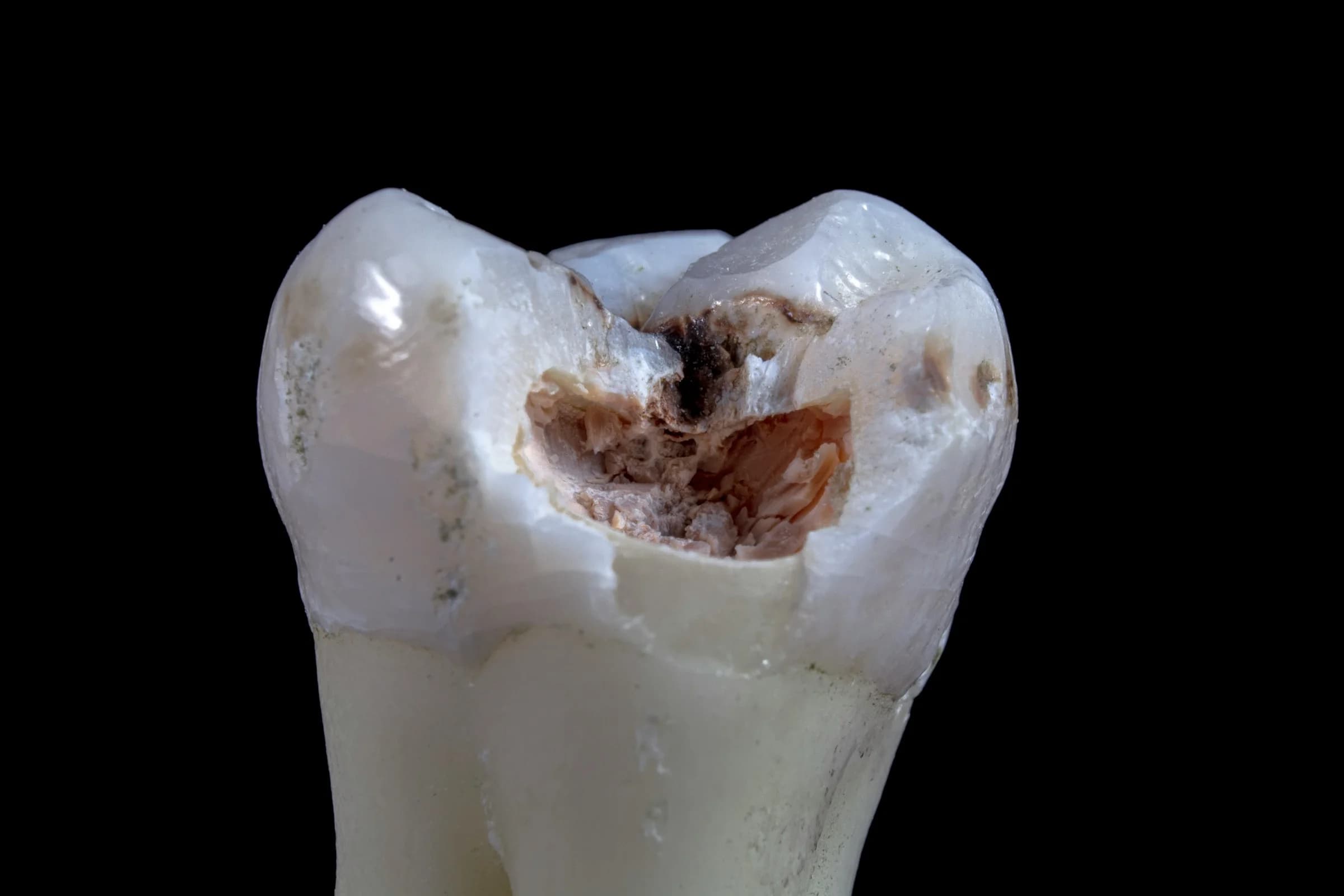 Dental care toothbrushes representing oral health and implant treatment