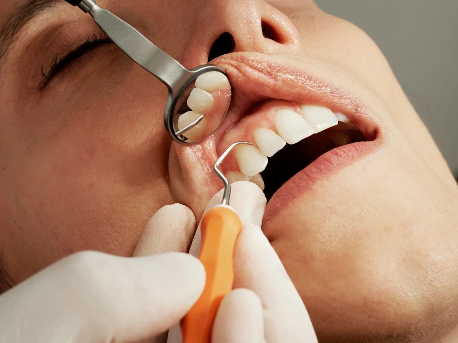 Dentist examining gums during a clinic visit