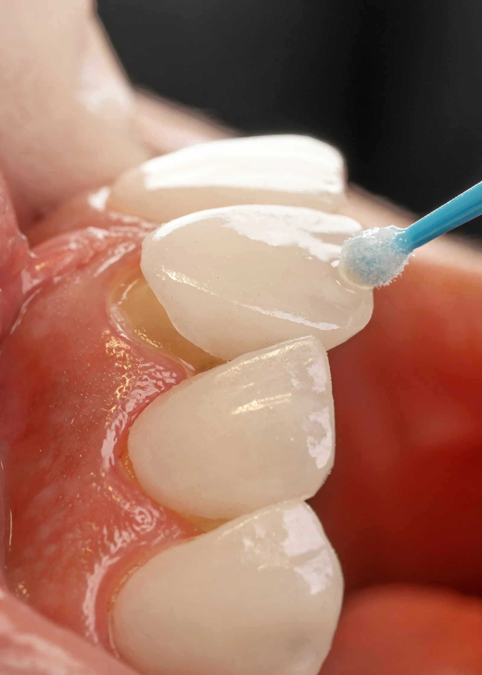 Cosmetic smile consultation in a dental clinic