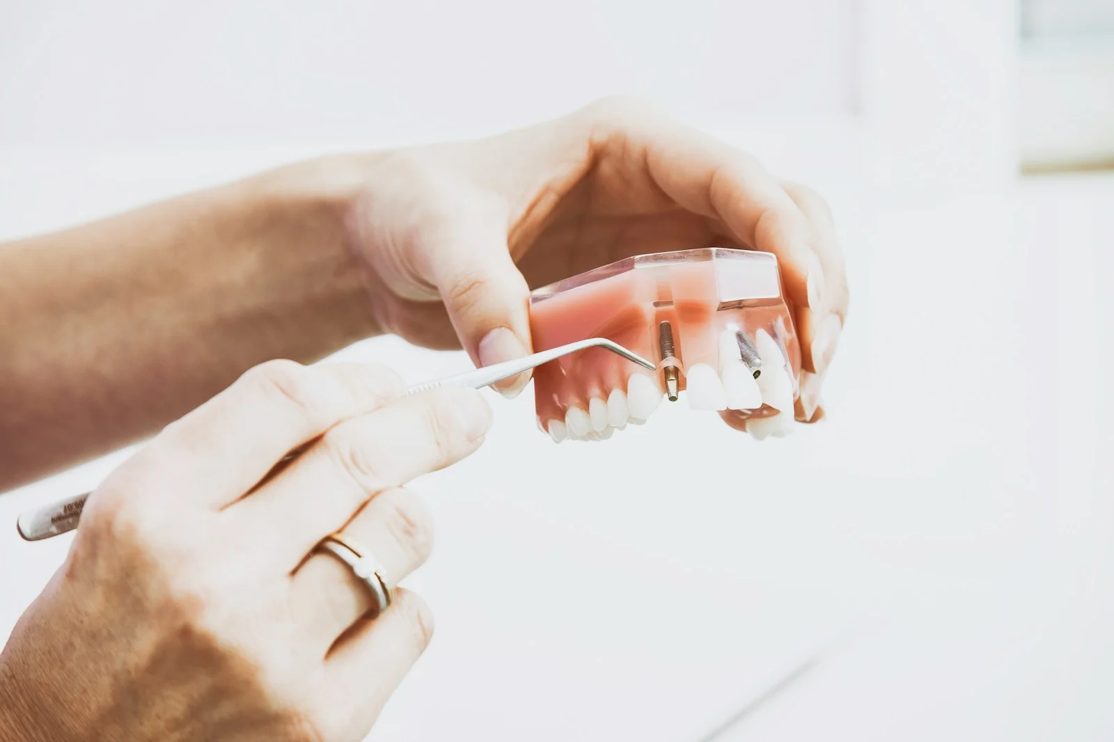 Comparing options for replacing a missing tooth